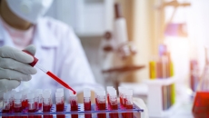 A lab assistant analysing blood samples