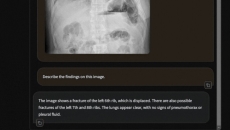 Screenshot of Harrison.rad.1 interface