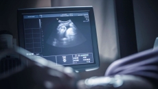 Sonogram monitor with person's hand