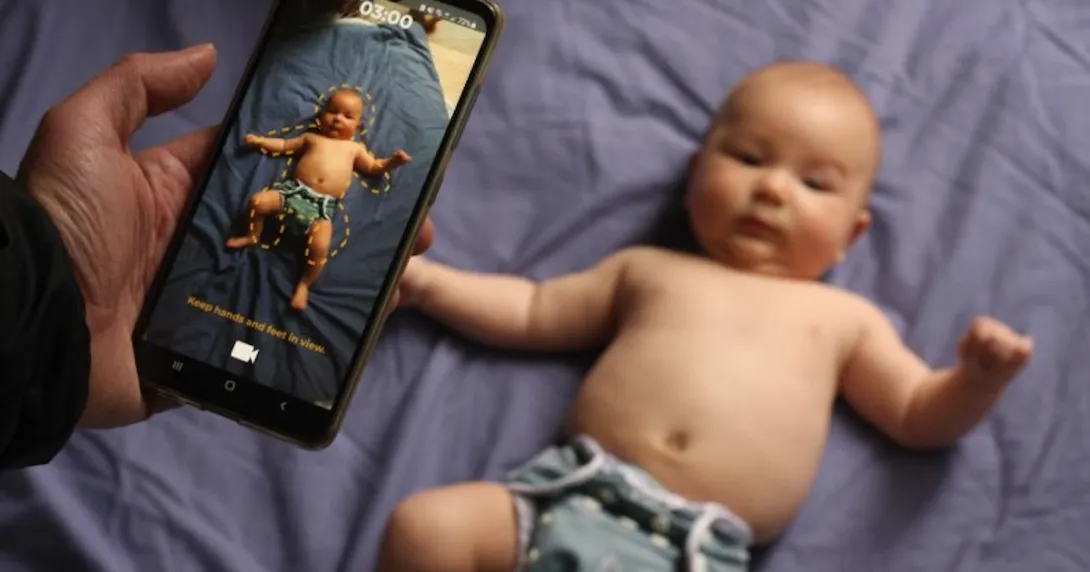 Mobile cerebral palsy assessment app by the University of Melbourne