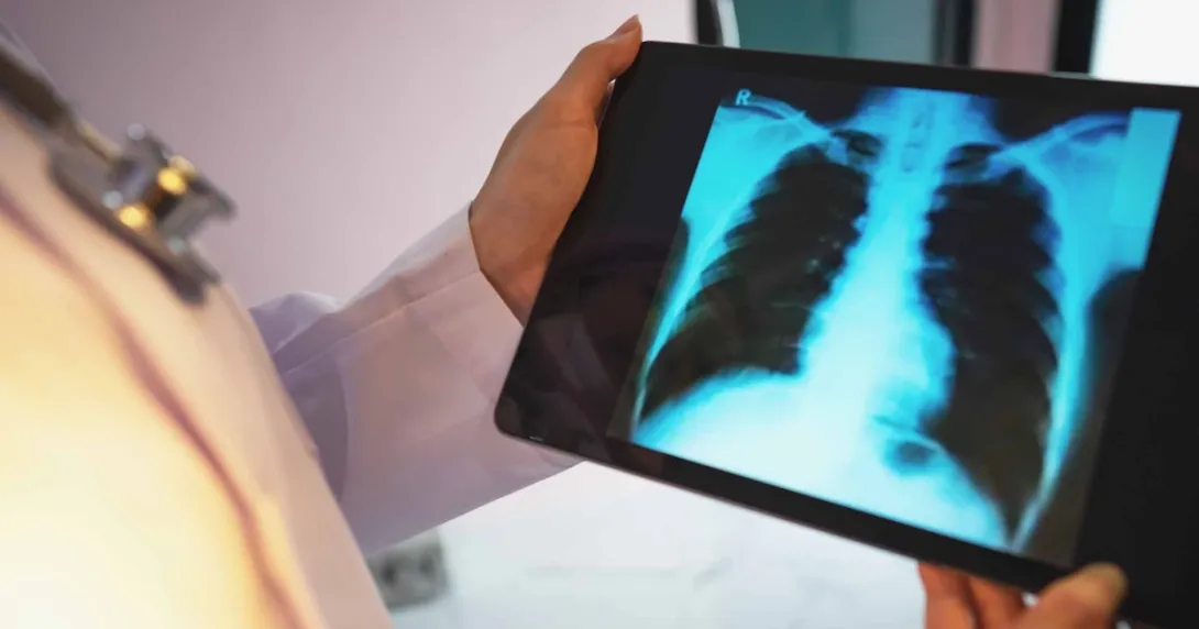Doctor checking a chest X-ray film on a tablet