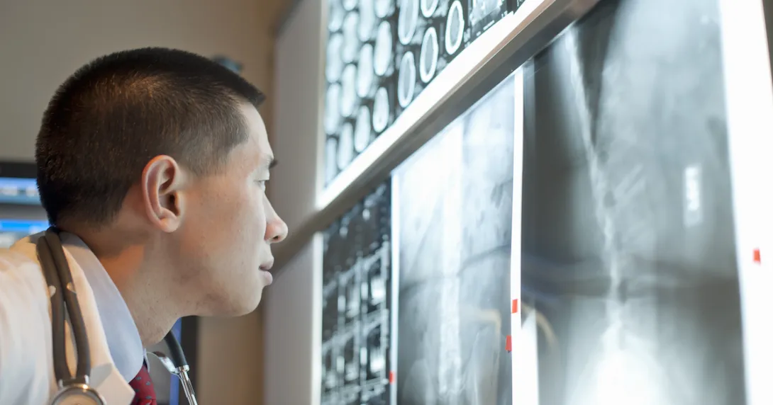 Healthcare provider analyzing diagnostic images hanging on a wall