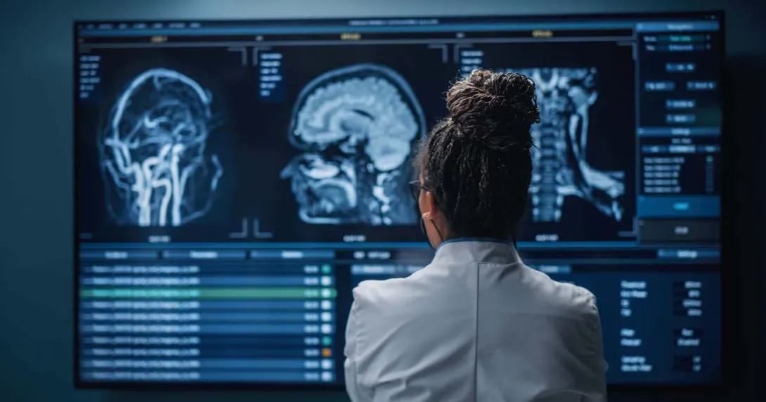 Healthcare provider looking at brain scan images