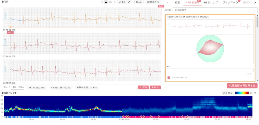 SmartRobin AI interface